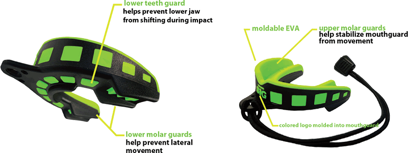 LOCKGARD MOUTHGUARD SPORT KIT GREEN/BLACK JUNIOR